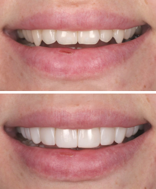 Smile before treatment